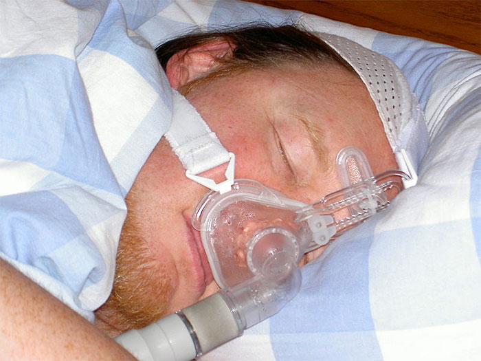 Treat Sleep Apnea Naturally